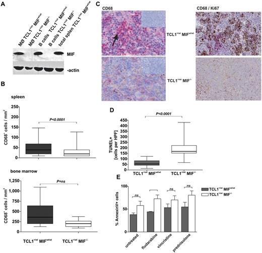 Figure 3. MIF deficiency leads to reduced numbers of TAMs and increased apoptosis of CLL cells. (A) MIF protein content determined by Western blotting in purified splenic macrophages and B cells and total splenocytes as control from TCL1+/wtMIFwt/wt and TCL1+/wtMIF−/− mice. β-actin as loading control. (B) Absolute numbers of CD68+ TAMs per mm2 in sections of enlarged spleens (top panel) and bone marrow (bottom panel) are higher in TCL1+/wtMIFwt/wt (n = 18) versus TCL1+/wtMIF−/− (n = 14) mice (spleen: P < .0001; bone marrow: P = .066). (C) Representative immunohistochemistry for CD68 in splenic sections of TCL1+/wtMIFwt/wt (top panel) and TCL1+/wtMIF−/− mice (bottom panel). Macrophage agglomerates (red, arrow) are present in spleens of TCL1+/wtMIFwt/wt mice, whereas macrophages are only sparsely distributed in TCL1+/wtMIF−/− mice. Insets represent negative control without primary antibody (10×magnification). Representative CD68/Ki67 double staining of TCL1+/wtMIFwt/wt and TCL1+/wtMIF−/− spleen showing accumulation of proliferating cells (brown) in areas of macrophage agglomeration in TCL1+/wtMIFwt/wt but not in TCL1+/wtMIF−/− spleen. (D) TUNEL-positive cells in splenic sections of TCL1+/wtMIFwt/wt and TCL1+/wtMIF−/− mice (n = 5 per genotype; 62 ± 7 in TCL1+/wtMIFwt/wt mice vs 192 ± 20 in TCL1+/wt MIF−/− mice; P < .0001). (E) Spontaneous and drug-induced rate of apoptosis as detected by flow cytometric positivity for annexin V/7-amino-actinomycin D in cultured nonleukemic splenocytes of TCL1+/wtMIF−/− versus TCL1+/wtMIFwt/wt mice. Cells were treated ex vivo with cytostatic drugs (50μM fludarabine, 61nM vincristine, 1μM prednisolone) for 24 hours. For each group and genotype, n = 5 independent splenocyte preparations were analyzed.