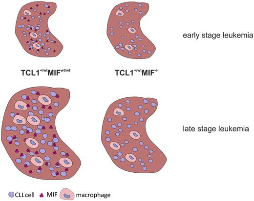 Figure 5. Effects of MIF in CLL. The chemokine MIF induces an increased recruitment of TAMs into the homing organs of CLL cells, such as the spleen. Macrophages support the survival of murine CLL cells (via MIF and other mediators), thereby generating a vicious circle that enhances the development of CLL.