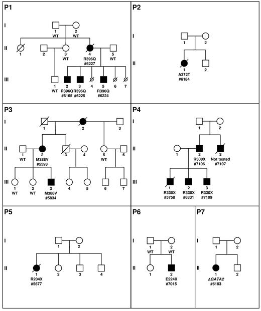 Figure 1. Pedigree description. P1 to P7 describes the pedigrees. Circles represent females and squares males. Parents are connected by a single horizontal line, and vertical lines indicate their offspring. Offspring are connected by a horizontal line. Siblings are placed from left to right according to birth order and are labeled with Arabic numerals. Each generation is indicated by a Roman numeral. Circles and squares are black when neutropenias have been formally identified. If a patient is dead, a diagonal line is placed over the circle or square. Smaller circles with a diagonal line indicate miscarriage (P1, III, 4; P1, III, 6) or termination because of AML induction treatment (P1, III, 7). Patients tested are indicated by the result of the GATA2 screening and a number (patient number 7107 was not analyzed). The absence (wild-type, WT) or presence of a GATA2 mutation (protein variation or complete deletion indicated by Δ) is indicated below the symbol of the patient tested.