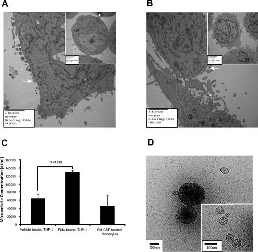 Figure 1. Microvesicle production during macrophage differentiation. (A) THP-1 cells were treated with vehicle (inset) or alternatively with PMA to induce differentiation and observed by electron microscopy, n = 3. (B) Freshly isolated peripheral blood monocytes were untreated for 30 minutes (inset) or GM-CSF for 4 hours then cultured overnight, n = 6. Images were captured with an AMT camera (Advanced Microscopy Techniques). Representative images are shown in panels A and B, and microvesicles are indicated by the white arrows in both panels. (C) THP-1 cells and peripheral blood monocytes were treated with PMA and GM-CSF, respectively. Microvesicle concentration containing both annexin V positive and negative events from the MV-gated region (supplemental Figure 1A) was quantified by flow cytometry. Shown is the average concentration ± SEM (n = 6). (D) The vitrified microvesicle samples were transferred to a Gatan Cryo holder and visualized with Tecnai G2 F20 ST TEM at 200 kV. Images were captured using a 4k × 4k Gatan Ultrascan CCD camera at a magnification of ×38 000. Representative cryo-TEM images of microvescicles collected using a 16 000g centrifugation from the culture supernatant of PMA-treated THP-1 cells are shown. Large (> 200 nm diameter) and small microvesicles (30-100 nm diameter; inset) are present. Scale bar = 100 nm in the figure and inset.