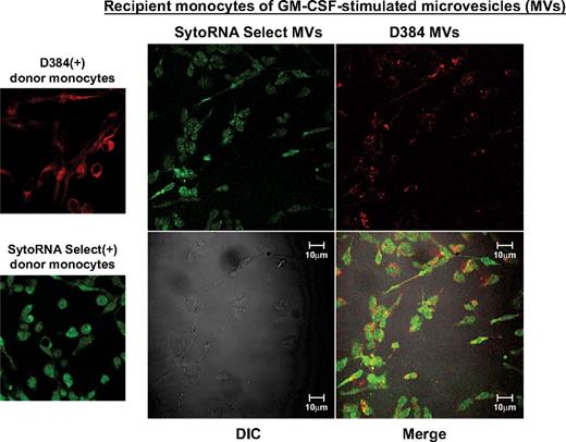 Figure 2. Microvesicle uptake by peripheral blood monocytes. Shown are confocal images from GM-CSF–treated donor monocytes stained with D384, a phospholipid membrane dye (red stain; top left panel) and SytoRNA Select, an RNA-select stain (green stain; bottom left panel). After 48 hours, microvesicles from GM-CSF–stimulated monocytes were collected. Based on previous studies,39 100 000 microvesicles/mL were incubated with unstained naive recipient cells. Cells were imaged using the Zeiss LSM 510 multiphoton confocal microscope. Background fluorescence was subtracted using unstained cells. Transfer of fluorescent microvesicles from the GM-CSF–stimulated cells was apparent in the recipient cell membranes and cytoplasm as indicated by the appearance of the red dye as well as transferred RNA as indicated by the green stain (right panel). The differential interference contrast (DIC) was used to visual the morphology of the cells without fluorescence. Data are representative of 3 independent monocyte donors and 3 monocyte recipients.
