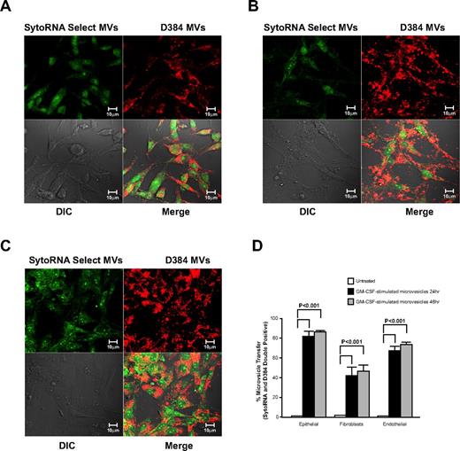Figure 5. Cellular uptake of microvesicles from GM-CSF–stimulated monocytes. Donor monocytes cells were stained with D384 and SytoRNA Select then treated with GM-CSF. Microvesicles from GM-CSF–stimulated monocytes were collected and added to different cells lines as indicated. Representative confocal images using the Zeiss LSM 510 multiphoton confocal microscope are shown. Microvesicles obtained from 3 individual monocyte donors revealed the uptake of the microvesicles by (A) A549 lung epithelial cells, (B) CCL-204 lung fibroblasts, and (C) human umbilical vein endothelial cells (HUVECs). (D) Quantification of microvesicle transfer from 3 independent experiments is shown (average ± SEM). Cellular morphology was visualized without fluorescence using differential interference contrast (DIC).