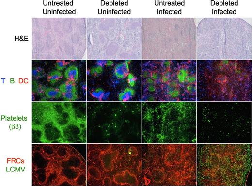 Figure 7. Organization of the splenic structure is disrupted by the LCMV infection in platelet-depleted mice. Four groups of mice were treated with PBS or 40 μg of anti-GPIIb antibody 12 hours before, and 2 and 4 days after LCMV Armstrong infection or PBS injection (group 1, nontreated and noninfected; group 2, treated and noninfected; group 3, nontreated and infected; and group 4, treated and infected). Spleens were collected from mice killed 8 days later and thin tissue sections were stained for light or immunofluorescence microscopy analysis. Figure shows representative photomicrographs of H&E (40×, top row); T, B, and DCs (Thy1.2, B220, CD11c; 50×, second row); platelets (β3 integrin; 50×, third row); or fibroblastic reticular cells and LCMV (ER-TR7 and anti-LCMV, 50×, bottom row; n = 5).