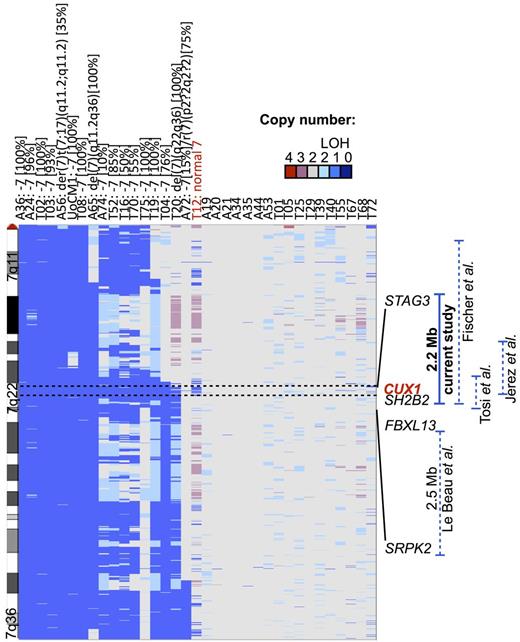 Figure 1. CUX1 is within the 2.17-Mb CDS of 7q22.1. Copy number analysis of 7q derived from SNP arrays of 35 samples of de novo AML or t-MNs. Thirty-four samples are from primary leukemia samples, and UoCM1 is a cell line derived from the leukemia cells of a patient with de novo AML. Seventeen samples have −7/del(7q) detected by cytogenetic analysis as depicted above the sample identifiers. The percentage of cells exhibiting the abnormality is indicated in brackets. T12 has a cryptic deletion in 7q22.1 not visible by conventional cytogenetic analysis. The CDS spans 49 genes; however, only the genes bordering the CDS are shown for clarity. Data are visualized with Integrated Genome Viewer Version 2.0.50 Previously identified commonly deleted segments are shown on the right panel, and genomic coordinates are indicated in build hg19. LOH indicates loss of heterozygosity.