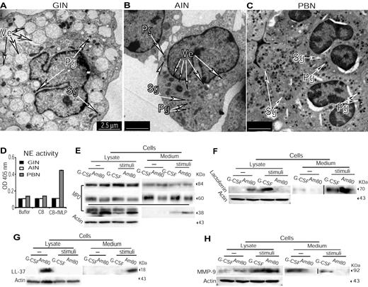 Figure 2. AINs produce and secrete granules more effectively than do GINs. (A-C) Ultrastructural images of GINs (A), AINs (B), or freshly isolated PBNs (C) with electron microscope. The vesicles in GINs appeared to contain less dense and amorphous material, whereas those in AINs showed dense material or both dense and amorphous material. AINs appeared to have more primary and secondary-like granules than do GINs. Arrows indicate examples of vesicles and granules. Ve indicates vesicle; Pg, primary granule; and Sg, secondary granule. (D) NE activity challenged by fMLP stimuli. CB indicates cytochalasin B. (E) AINs had a greater production and secretion of the cleaved 38-kDa product of MPO upon E coli stimuli. Images at the top of the horizontal line were derived from 8% gel, whereas images under the horizontal line from 12% gel. The band intensities of Actin detected in 12% gel are similar to those in 8% gel (data not shown). (F) Effective secretion of lactoferrin by AINs versus GINs upon E coli stimuli. To make the sample orders in the medium section match those in the lysate section, the positions between nonstimulated and stimulated samples in the medium section have been switched, as indicated by a vertical line. (G) Greater production and degranulation of LL37 by AINs versus GINs. (H) Increased abundance of intracellular MMP-9 upon E coli stimuli but insufficient degranulation in both GINs and AINs. To make the sample orders in the medium section match those in the lysate section, the positions between nonstimulated and stimulated samples in the medium section have been switched, as indicated by a vertical line. In addition, the samples loaded in lysate and medium sections in panels E through H were originally separated by a molecular weight (MW) marker. This MW marker was deleted so that a blank space is shown between lysate and medium samples.