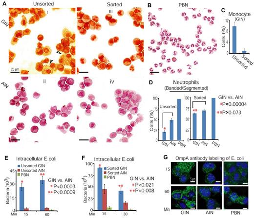 Figure 3. Both unsorted and sorted AINs display a higher capacity for clearance of bacteria than do unsorted and sorted GINs. (A) Morphology of GINs and AINs before and after sorting with anti-CD15 antibody. Arrows indicate examples of monocytes. (B) Morphology of freshly isolated PBNs. (C-D) Quantification of monocytes (C) and band/segmented neutrophils (D) in panels A and B. (E-F) Comparison of the effect of unsorted and sorted GINs and AINs on the clearance of intracellular bacteria. Clearance efficiency was determined from the numbers of viable bacteria recovered from the intracellular compartment after infection. E coli DH5α at an MOI of 100 were used to infect sorted GINs, sorted AINs, and PBNs (F). (G) In situ labeling of bacteria with anti-OmpA antibodies in unsorted GINs and AINs.
