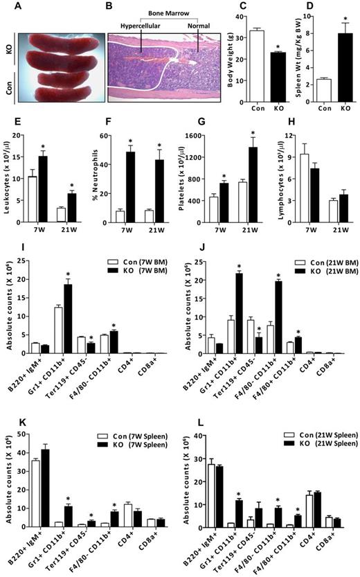 Figure 2. Osteocyte-specific loss of Gsα results in expansion of myeloid cells in BM and spleen. (A) Splenomegaly in OCY-GsαKO (KO) mice compared with controls (Con). (B) Representative areas of hypercellularity in BM of OCY-GsαKO femurs. (C) Decreased whole-body weight and (D) increased normalized spleen weights in OCY-GsαKO mice (n ≥ 7). (E-H) PB counts showing (E) number of leukocytes, (F) % neutrophils, (G) number of platelets, and (H) number of lymphocytes in 7- and 21-week-old control and OCY-GsαKO female mice (n ≥ 9). (I-L) Immunophenotypic analysis of hematopoietic cells in BM and spleen showing absolute counts for B cells (B220+ IgM+), granulocytes (Gr1+ CD11b+), erythroid cells (Ter119+ CD45−), monocytes (F4/80− CD11b+), macrophages (F4/80+ CD11b+), T cells (CD4+), and cytotoxic T cells (CD8a+) in BM (I-J) and spleens (K-L) of 7-week-old (I,K) and 21-week-old (J,L) control and OCY-GsαKO female mice (n ≥ 6). Error bars represent mean ± SEM. *P < .05 by t test.
