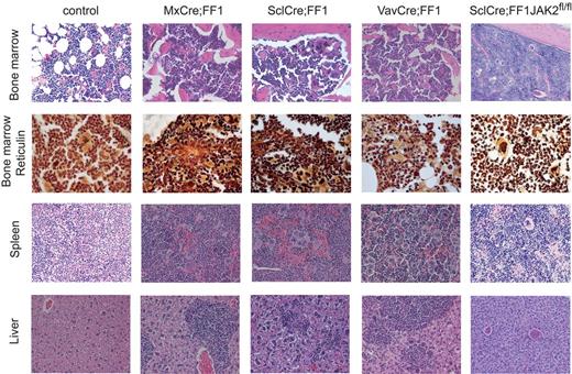 Figure 2. Histopathology of H&E-stained tissue samples. Magnification is 20× except for the second row that was prepared with Gömöri staining to visualize reticulin fibers (magnification, 40×). The mice were killed at 28-30 weeks of age (controls and VavCre;FF1) or 28-30 weeks after induction with pIpC (MxCre;FF1) or tamoxifen (SclCre;FF1). Because of the markedly reduced likelihood of survival, SclCre;FF1;Jak2fl/fl mice were killed 14 weeks after induction with tamoxifen.
