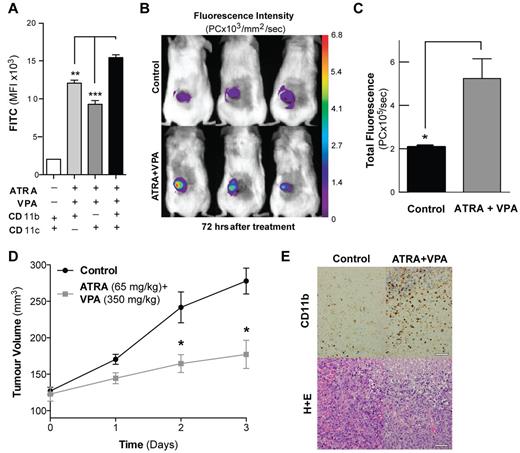 Figure 4. In vivo imaging of differentiation therapy with multiplexed mAbs. (A) Differentiation of NB4 cells treated for 48 hours with a combination of ATRA (1 μM) and VPA (1 mM) as evaluated with CD11b, CD11c or multiplex of both by flow cytometry. Multiplexing of both mAbs provides significant increases in mean fluorescence intensity. **P < .01; ***P < .001. (B) Subcutaneous tumors (n = 4) treated with ATRA (60 mg/kg) and VPA (350 mg/kg) for 3 days show significant increases in fluorescence intensity (C; *P < .05) and reduced tumor growth (D; *P < .05) compared with controls (means ± SEM, n = 3) and confirmed ex vivo by immunohistochemistry of tumors with CD11b (E). Scale bars: yellow indicates 20×, 0.1 mm; white, 40×, 0.05 mm.