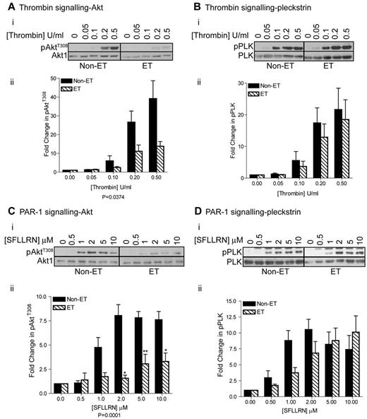 Figure 5. Impaired activation of the PI3 kinase/Akt pathway in platelets from JAK2V617F-ositive ET patients. Washed platelets from control and ET patients were stimulated with the indicated concentrations of thrombin (A, n = 5, B, n = 6) and SFLLRN (C, n = 5, D, n = 10) for 2 minutes before extraction in 4× NuPage lysis buffer and immunoblotting with the indicated antibodies. (i) A representative blot is shown. (ii) The bar graphs (average ± SEM) show the fold-increase in pAktT308 and p-PLK stimulation and are corrected for total Akt and pleckstrin levels.
