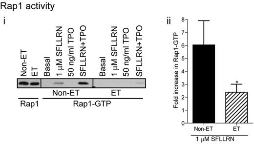 Figure 7. Impaired Rap1 activation in platelets from JAK2V617F-positive ET patients. Washed platelets from control and ET patients were stimulated for 5 minutes with SFLLRN, TPO, or a combination of TPO and SFLLRN. Rap1 activation was subsequently analyzed by GST-RalGDS pull-down and immunoblotting for Rap1 (i). The bar graph shows the average (± SEM) fold-change in Rap1 activation on SFLLRN stimulation (ii, n = 7).