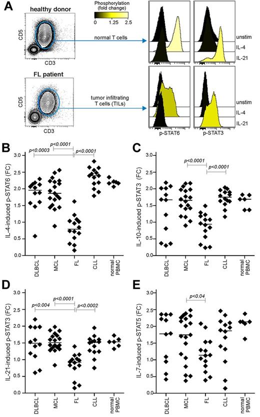 Figure 1. Tumor-infiltrating T cells in FL biopsies have suppressed cytokine signaling. Tumor specimens from patients with DLBCL, MCL, FL, or CLL or PBMCs from healthy donors were stimulated with cytokines for 15 minutes. Signaling was then stopped by fixation, followed by permeabilization and detection of cytokine-induced phosphorylation of STATs by phospho-flow cytometry. (A) Representative FACS plots of TILs or normal PBMC T cells were identified on the basis of their coexpression of CD3 and CD5, lack of CD20 expression, and histograms of IL-4–induced p-STAT6 and IL-21–induced p-STAT3 in TILs from a FL tumor sample (FL-J117) and a healthy donor shown as median fold change, relative to unstimulated cells. On the archsinh scale, a FC of 1.75 corresponds to a difference of 1 log10. Scatter plots of cytokine-induced phosphorylation in TILs from DLBCL, MCL, FL, and CLL and PBMC T cells from healthy donors. (B) IL-4–induced p-STAT6, (C) IL-10–induced p-STAT3, (D) IL-21–induced p-STAT3, and (E) IL-7 induced p-STAT5. Each dot represents one patient sample: DLBCL, n = 12; MCL, n = 19; FL, n = 14; CLL, n = 14; and healthy donor PBMCs (normal), n = 6. Significance between groups was determined by unpaired Mann-Whitney U test.