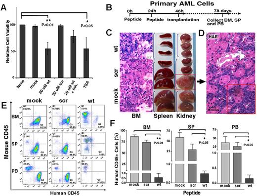 Figure 5. Treatment of SALL4 peptide in primary human AML cells induces reduced cell viability in culture and impaired leukemic engraftment in vivo. (A) wt peptide treatment reduces cell viability of human AML cells in culture and this effect can be reversed in part by the PTEN inhibitor SF1670. A total of 1 × 106 AML cells were left untreated (None); treated with Pep-1 alone (Mock); treated with 20μM wt or scr peptide; treated with wt peptide + 400nM PTEN inhibitor SF1670 (wt + inh); or treated with 100nM TSA for 48 hours, as described in “Methods.” Cell viability of untreated primary AML cells is set as 100 (n = 3 biologic samples). Error bars indicate SD. (B) Schematic diagram showing the steps and time course of the peptide treatment in the xenotransplantation assay. One million primary human leukemic cells were treated twice with peptides at a 24-hour interval, followed by transplantation into sublethally irradiated NSG mice. Mice were killed when they became ill. (C) Wright-Giemsa staining of a cytospin preparation of BM from scr- or carrier alone–treated mice shows marked expansion of immature blasts, which is not present in the wt-treated recipient BM (left panel) Scale bar indicates 10 μm. The scr- or Pep-1 carrier alone–treated mice also have enlarged spleens (middle panel) and kidneys (right panel), whereas the wt-treated recipient mice show normal spleens and kidneys. (D) Histology section of the kidney (arrow) shows effacement of normal architecture by leukemic infiltration. Scale bar indicates 20 μm. (E-F) SALL4 wt peptide treatment significantly impaired human AML cell engraftments in NSG mice analyzed at 78 days after transplantation. The percentage of human CD45+ cells engrafted in the BM, spleen, and peripheral blood was determined by flow cytometry. Representative FACS results from wt, scr, and Pep-1 carrier–only (mock) treatments are shown in panel E and a statistical summary is shown in panel F (n = 5 mice per group). P < .01 in BM; P < .05 in the spleen and peripheral blood by ANOVA with the Tukey multiple comparison test.