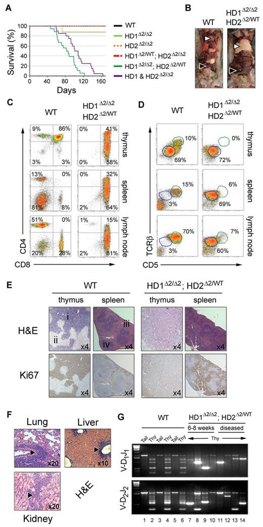 Figure 5. Development of pathologic diseased state in Hdac1Δ2/Δ2; Hdac2Δ2/WT and Hdac1&2Δ2/Δ2 mice. (A) Kaplan-Meier survival curve. WT (n = 13), Hdac1Δ2/Δ2 (n = 8), Hdac2Δ2/Δ2 (n = 11), Hdac1Δ2/WT; Hdac2Δ2/Δ2 (n = 5), Hdac1Δ2/Δ2; Hdac2Δ2/WT (n = 18, median length of survival = 12 weeks) and Hdac1&2Δ2/Δ2 (n = 20, median length of survival = 15 weeks). (B) Enlarged thymus (white triangles) and spleen (black triangles) representative of Hdac1Δ2/Δ2; Hdac2Δ2/WT and Hdac1&2Δ2/Δ2 diseased mice. A WT LMC is also shown (left panel) for comparison. (C-D) CD4/CD8 and TCRβ/CD5 expression profiles of thymocytes, splenocytes and lymphocytes from diseased and aged matched WT LMCs. (E) Serial thymic sections from WT LMCs and diseased Hdac1Δ2/Δ2; Hdac2Δ2/WT mice stained with hematoxylin and eosin (H&E), or Ki67 counterstained with eosin, (i) cortex, (ii) medulla. (F) H&E-stained sections show infiltration of lung, liver and kidney in diseased Hdac1Δ2/Δ2; Hdac2Δ2/WT mice (6/14 cases analyzed). (G) Thymocyte clonality analysis: PCR was used to determine Dβ1-Jβ1 and Dβ2-Jβ2 rearrangement at the TCRβ locus of tail and thy (thymus) gDNA from the genotypes indicated.