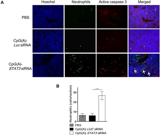 Figure 7. Local delivery of CpG(A)-STAT3 siRNA into xenotransplanted leukemia induces tumor cell death and stimulated neutrophil infiltration. (A-B) Effects of IT delivery of CpG(A)-STAT3 siRNA on tumor cell apoptosis and neutrophil infiltration. Mice xenotransplanted with MV4-11 leukemia were treated by 4 IT injections of CpG(A)-siRNA targeting STAT3 or Luc as a negative control. Tumors were harvested 1 day after the last treatment, frozen, and sectioned. (A) Tissue cryosections were immunofluorescently stained using antibodies to neutrophils (7/4, green) and activated caspase-3 (red). Slides were counterstained using Hoechst 33342 to visualize nuclei (blue) and analyzed by fluorescent microscopy. Shown are representative results from 2 independent experiments using tumor sections from 4 mice per group; arrows indicate contact sites between neutrophils and cells undergoing apoptosis. (B) Quantification of neutrophil infiltration using at least 20 randomly chosen fields. Statistically significant differences between treatment groups (from 2-way ANOVA) are indicated by asterisks. Data are shown as means ± SEM (n = 4). ***P < .001.