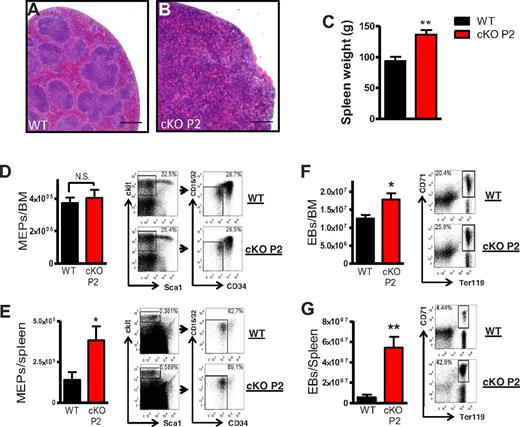 Figure 3. Erythrocytosis is mainly caused by extramedullary erythropoiesis in the spleen. (A-B) Representative sections of WT and cKO P2 spleens (H&E) show an extensive structural loss and an augmentation of nucleated cells in erythrocytotic cKO P2 mice. (C) Spleen weight of WT and cKO P2 mice (n = 10-16). (D-G) Representative FACS staining profiles of (D and E) megakaryocyte-erythrocyte progenitors (MEP; n = 6) and (F-G) erythroblasts (EB; n = 7) in BM and spleen of WT and cKO P2 showing that the overproduction of RBCs is mainly executed in the spleen. Scale bars represent 500 μm. All data are mean ± SEM (*P < .05, ***P < .001).
