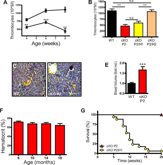 Figure 4. cKO P2 mice show thrombocytopenia but no early lethality, whereas cKO P2/H1 die prematurely. (A) Thrombocyte concentrations in the blood of WT and cKO P2 mice until adulthood reveal a significant reduction of circulating platelets per volume of blood in cKO P2 mice (n = 5-10). WT is represented by black squares and cKO P2 by red triangles. (B) Eight- to 10-week-old mice were bled and thrombocytes measured in a fixed volume of blood showing thrombocytopenia in cKO and cKO P2/H1 mice compared with WT and cKO P2/H2 mice (n = 6-7). (C-D) WT and cKO P2 kidneys stained with acid Fuchsin orange-G show no signs of microvascular thrombosis suggesting that platelets are not trapped within blood clots. (E) Instead, the total blood volume of cKO P2 mice was significantly increased compared with WT mice (n = 9-10). (F) 9 cKO P2 mice (5 females and 4 males) were kept for 20 months. Mice were bled every 4 months to measure HCTs. No significant differences in HCTs were found and none of the mice died before the end of the experiment. (G) cKO P2/H1 (n = 17) and cKO P2 (n = 15) mice were followed for 20 weeks. cKO P2/H1 mice began to die from week 5 after birth. By week 16, 16 of 17 mice were deceased. No cKO P2 mice died during the course of this experiment. Scale bars represent 100 μm. All data are mean ± SEM (**P < .01, ***P < .001).