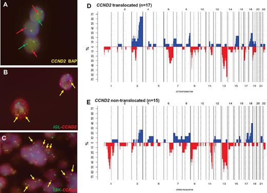 Figure 2. Genetic features of cyclin D1− MCL. (A) FISH analysis shows CCND2 breaks in patient ID36. (B) FISH image shows an IGL-CCND2 fusion in patient ID36. (C) FISH image shows and IGK-CCND2 fusion in patient ID28. Frequency of genetic alterations in CCND2 translocation–positive (D; n = 17) and CCND2 translocation–negative (E; n = 15). On the x-axis, the chromosomes are represented horizontally from 1-22; on the y-axis, the percentages of patients with CNAs are shown. Gains are represented on the positive y-axis and colored in blue and losses are represented on the negative y-axis in red.