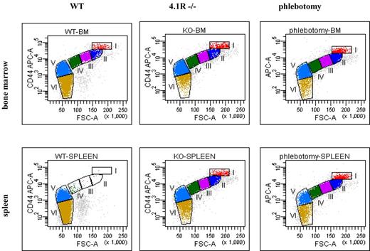 Figure 2. Representative erythropoiesis profiles of bone marrow and spleen of 4.1R−/− and phlebotomy-induced mice. (Top panel) Representative erythropoiesis profiles of bone marrow. Note that there is an increased proportion of nucleated erythroblasts (I+II+III+IV) which is accompanied by a decreased proportion of enucleated erythrocytes (V+VI) in both 4.1R−/− and phlebotomy-induced WT bone marrow compared with WT bone marrow. (Bottom panel) Representative erythropoiesis profiles of spleen. Note that there are very few erythroblasts in WT spleen but a large proportion of nucleated erythroblasts in the spleens of both 4.1R−/− and phlebotomy-induced WT anemic mice.