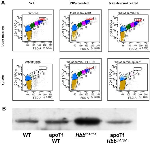 Figure 3. Altered terminal erythroid differentiation of Hbbth1/th1 mice and normalization after thansferrin therapy. (A) Representative erythropoiesis profiles of bone marrow and spleen of Hbbth1/th1 mice. (Top panel) The representative erythropoiesis profiles of bone marrow. A decrease in fraction I (proerythroblast) and fraction VI (mature red cells) is clearly seen in PBS-treated thalassemia bone marrow and is restored in transferrin-treated bone marrow. (Bottom panel) Representative erythropoiesis profiles of spleen. There are very few erythroblasts in WT spleen, but the spleen of thalassemia mouse is highly erythropoietic and is restored in transferrin-treated spleen. (B) Western blot revealed an increase in soluble serum TfR1 in Hbbth1/th1 relative to WT mice and is normalized after transferrin treatment.