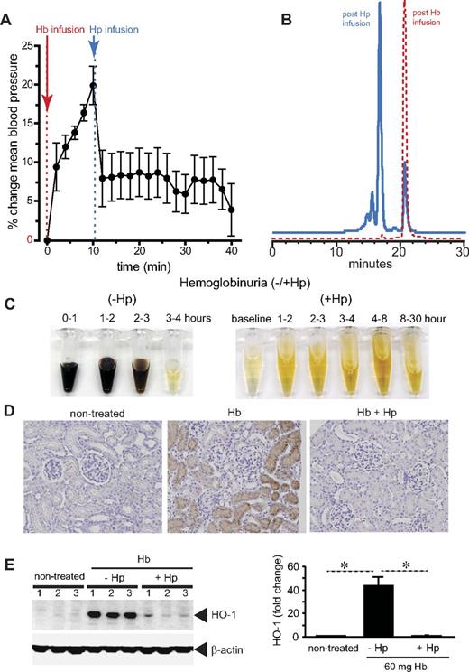 Figure 3. Hp sequestration of Hb. Guinea pigs were infused with stroma-free Hb (peak plasma Hb concentration, 150μM heme) and, after 10 minutes, a treatment group of animals was infused with human plasma–derived Hp to match an equimolar Hb:Hp concentration. (A) Mean arterial blood pressure response before and after Hp treatment. (B) Unbound plasma Hb (red) before and after Hp administration. The left shift in the chromatogram indicates the large molecular size Hb:Hp complex with approximately 90% Hp bound and 10% unbound Hb. (C) Hemoglobinuria after Hb infusion (150μM heme) without (−Hp, left) and with Hp (+Hp, right). (D) Iron deposition (brown staining) in normal kidney renal cortex (left), Hb infusion (middle), and Hb infusion plus Hp (right). (E) HO-1 expression in kidneys after 24 hours after Hb exposure with and without Hp infusion (left). Densitometry is shown to the right of the HO-1 Western blot. All data are presented as means ± SEM.