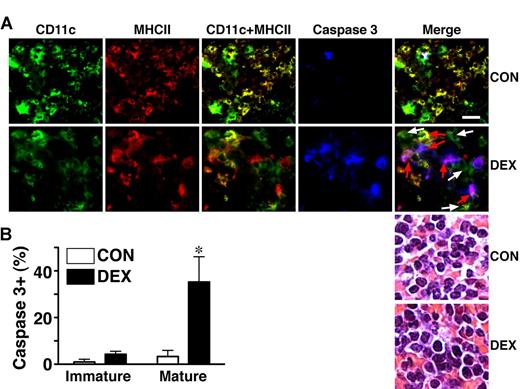Figure 1. Distinct glucocorticoid sensitivities of immature and mature DCs in murine spleen. (A) Triple immunostaining shows caspase 3 activation in DCs on spleen sections in control (CON) and DEX (5 mg/kg, intraperitoneally, 24 hours) treated animals. Immature DCs (white arrows) in mouse spleen sections were CD11c+MHC II−/low whereas mature DCs (red arrows) were CD11c+MHC IIhigh. CD11c, MHC II, and activated caspase 3 signals were indicated in green, red, and blue, respectively. Sections from control animals showed few cells with activated caspase 3 staining. Bright field images of hematoxylin and eosin stained sections indicate the cell numbers. Scale bar, 20 μm. (B) Percentages (± SD) of caspase 3+ cells were compared between CON and DEX. Approximately 150 to 600 cells per animal (n = 6 per group) were counted across 3 to 12 sections (*significantly greater than CON; P < .0001, Student t test).
