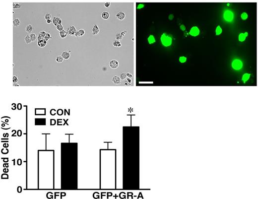 Figure 6. GR translational isoforms mediated the distinct glucocorticoid responses in immature and mature DCs. Ectopic expression of the GR-A isoform in immature BMDCs enabled glucocorticoid killing. The efficiency of Amaxa transfection of BMDCs was greater than 50%. Positively transfected cells were harvested using the Moflo cell sorter. DEX (100nM) treatment was 24 hours and dead cells were detected using propidium iodide staining (± SD, n = 3; *significantly greater than CON, P < .05; Student t test). Scale bar, 30 μm.