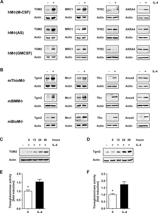 Figure 5. Conserved macrophage alternative activation gene and protein signatures reveal TGM2 as the most stable marker. (A) Up-regulation of TGM2 protein by M2 activation can be confirmed by Western blot in different human macrophage culture models (M-CSF, GM-CSF, and AS). Analysis of Mannose receptor (MRC1) and Actin expression were used as alternative activation and loading controls, respectively. In addition, expression of transferrin receptor (TFRC) and annexin A4 (ANXA4) was determined. (B) In mouse macrophage protein samples, IL-4–induced Tgm2 up-regulation can be confirmed in thioglycollate- (mThioMΦ) and Biogel (mBioMΦ)–elicited peritoneal macrophages and BM-derived macrophages (mBMMΦ). Mrc1, Tfrc, Anxa4, and Actin expression was analyzed in parallel. (C-D) Time-course analysis of TGM2/Tgm2 in human AS macrophages (C) and mouse ThioMΦ (D). (E-F) Transglutaminase activity was determined in human AS macrophages (E; n = 3) and mouse ThioMΦ (F; n = 4). *P < 0.05. Shown are means ± SEM. Transglutaminase activity was normalized to the amount of protein and to the unstimulated control.