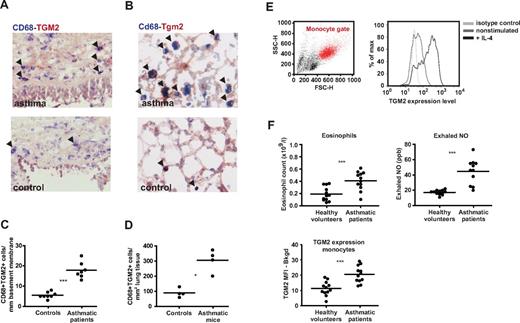 Figure 6. TGM2 is a conserved M2 marker that is highly expressed in asthma. (A-B) TGM2 and CD68 expression was analyzed in bronchial biopsies of asthma patients (A) and lung sections of mice with asthma (B). Shown are representative sections stained for CD68 (blue) and TGM2 (red). Arrowheads indicate double-positive cells. (C) Airway wall tissue of asthmatic patients contains more TGM2+ macrophages than that of healthy controls. ***P < .0001. (D) Lung tissue of mice with asthma contains more TGM2+ macrophages than that of control mice. *P = .0286 by 2-tailed unpaired t test. (E) TGM2 is also expressed in monocytes as detected by FACS. Monocytes were gated according to their forward/side scatter (red); monocytes were left untreated or stimulated with IL-4. (F) Asthmatic patients showed significantly increased eosinophil counts (***P < .0001) and exhaled NO levels (***P = .0003). In blood samples of these patients, TGM2 levels in circulating monocytes were significantly higher in asthmatic patients than in healthy controls (***P = .0002 by 2-tailed unpaired t test with Welch correction). TGM2 MFI − bkgd = mean fluorescence intensity (MFI) detected with a primary polyclonal antibody subtracted by the MFI detected with control Igs. Eos indicates eosinophil counts.