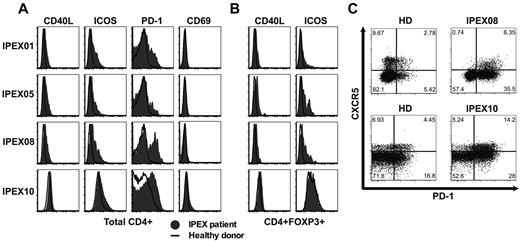 Figure 6. IPEX patients harbor activated T cells including Tfh-like cells. Increased expression of CD40L, ICOS, and PD-1 but not CD69 on total (A) CD3+CD4+ cells and (B) CD3+CD4+FOXP3+ cells in IPEX patients (solid gray) compared with healthy donors (bold). (C) Increased PD-1 expression on circulating CD4+CXCR5+ cells reveals Tfh-like cells in IPEX patients.