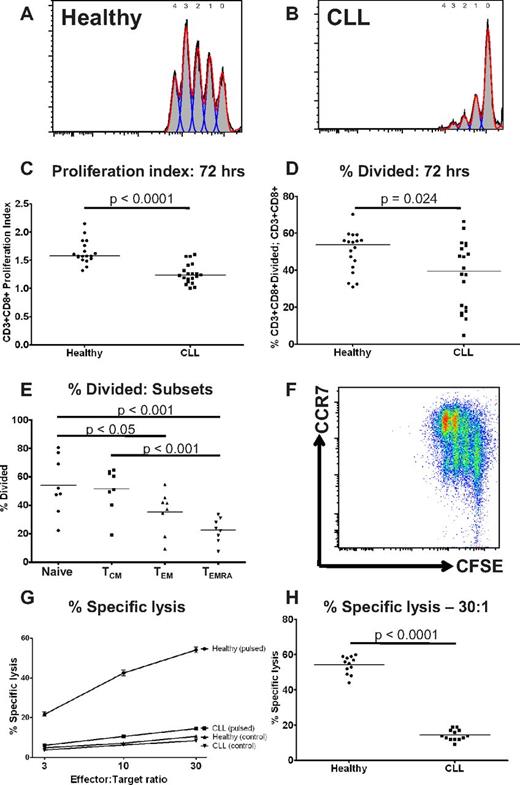 Figure 3. CD8+ T cells from patients with CLL show functional defects in proliferation and cytoxicity. The proliferative potential of CD8+ T cells from CLL patients and healthy controls was assessed using a CFSE based assay. Representative histograms are shown of (A) a healthy donor and (B) a CLL patient. (C) The proliferation index was significantly lower for CD8+ T cells from CLL patients compared with healthy controls. (D) There was also a reduction in the proportion of CD8+ T cells that had entered cell division (percentage divided) in CLL patients compared with healthy controls. The proliferative capacity of the various CD8+ lymphocyte subsets as defined by coexpression of CCR7 and CD45RA was assessed. (E-F) CD8+CCR7− T cells (TEM and TEMRA) had reduced proliferative capacity compared with CD8+CCR7− T cells (Naive and TCM). The cytotoxic activity of CD8+ T cells from patients and controls was assessed. CD8+ T cells from CLL patients fail to lyse idiotype-pulsed target cells in contrast to CD8+ T cells from healthy controls: percentage specific lysis at all effector target ratios (G), and at a effector-target ratio of 30:1 (H).