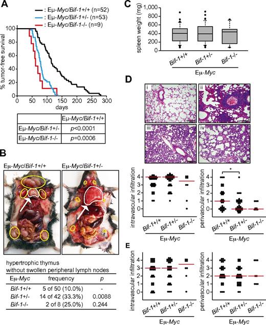 Figure 1. Loss of Bif-1 promotes Myc-driven lymphoma development. (A) Kaplan-Meier tumor-free survival of Eμ-Myc/Bif-1+/+ (n = 52; median onset, 107 days), Eμ-Myc/Bif-1+/− (n = 53; median onset, 75 days), and Eμ-Myc/Bif-1−/− (n = 9; median onset, 65 days) mice is shown. Statistical significance was determined using a log-rank test. (B) Bif-1 haploinsufficiency enhances the frequency of thymic lymphoma in Eμ-Myc–transgenic mice. Gross images of typical lymphomatous Eμ-Myc/Bif-1+/+ and Eμ-Myc/Bif-1+/− mice with thymic lymphoma are shown. The lymph nodes and thymus are outlined by yellow circles and a white circle/arrow, respectively. Statistical significance was determined using a Fisher exact test. (C) The weights of spleens from all of the mice used in this figure were measured at the onset of lymphoma and are shown as a box plot. The lines, boxes, and error bars represent median values, 25-75 percentiles, and the 10-90 percentiles, respectively. (D-E) Allelic loss of Bif-1 suppresses lung perivascular tumor formation in Eμ-Myc–transgenic mice. The lungs (D) and livers (data not shown) from lymphomatous Eμ-Myc/Bif-1+/+ (n = 34; ii), Eμ-Myc/Bif-1+/− (n = 38; iii), Eμ-Myc/Bif-1−/− (n = 8; iv), and control Bif-1+/+ mice (i) were stained with H&E. The degree of lymphoblast infiltration to pulmonary alveolar septa (D) or hepatic sinusoids (E) and perivascular interstitial stroma expanded by lymphoblasts (D-E) were scored as follows: 0 = normal; 1 = < 5%; 2 = 6%-15%; 3 = 16%-40%; and 4 = > 40%. The lines represent median values. Statistical significance was determined using a 2-way ANOVA followed by a Scheffe posthoc test. *P < .05.