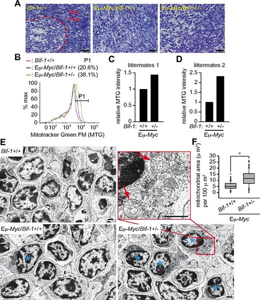 Figure 4. Bif-1 haploinsufficiency results in an increase in mitochondrial mass at premalignant stage of Myc-induced lymphoma. Prelymphomatous spleens were isolated from male littermate mice at the age of 12 weeks (panels A-C and E-F) and 10 weeks old (panel D). (A) Tissues were divided into 2 parts and a portion processed for electron microscopic analysis was stained with methylene blue and Azure II. (B) Splenocytes were prepared from another half portion of tissue, stained with MitoTracker Green FM for 30 minutes, and analyzed by flow cytometry. The percentages of cells with increased numbers of mitochondria by Myc are shown. (C-D) Geometric means of MitoTracker Green FM signals quantified and shown as relative intensities. (E) Tissue blocks in panel A were sectioned and analyzed by electron microscopy. The scale bars represent 1 μm. (F) Total mitochondrial area per cytoplasmic area in Eμ-Myc/Bif-1+/+ (n = 136) and Eμ-Myc/Bif-1+/− (n = 129) cells in panel E was quantified using ImageJ software and is shown as a box plot. The lines, boxes, and error bars represent median values, 25-75 percentiles, and 10-90 percentiles, respectively. Statistical significance was determined using a Wilcoxon rank-sum test with continuity correction. *P < .0001.