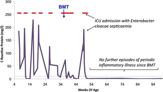 Figure 5. Graphical representation of selected clinical events in child 11’s early disease course. Line graph traces serial C-reactive protein levels, illustrating recurrent inflammatory episodes occurring with periodicity of 4- to 6-week intervals; red lines represent periods of hospitalization. Other than a single early episode of Enterobacter septicemia, BMT appears to have effectively cured the immunologic and fever components of the disease as well as the SA.