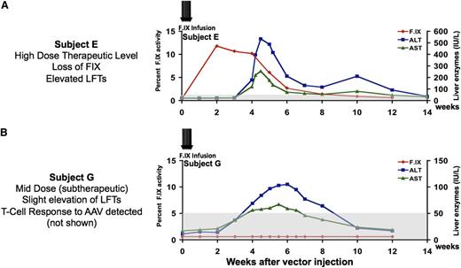 Figure 2. Clinical results following hepatic artery infusion of AAV2-F.IX. (A) Time course of F.IX levels and of transaminases in first subject to receive high-dose AAV2-F.IX (2 × 1012 vg/kg) in hemophilia B trial. An F.IX level (red) of ∼10% persists for 4 weeks and then slowly declines, concomitant with a self-limited rise in liver transaminases, which peaked at levels close to 10-fold over the baseline and then gradually fell, in tandem with a falling F.IX level, so that all laboratory parameters had returned to the patient’s baseline by ∼12 weeks after vector infusion (ALT, blue; AST, green). The patient remained asymptomatic throughout these events and, when tested subsequently, responded normally to infused recombinant F.IX. (B) A subsequent subject received a fivefold lower dose, 4 × 1011 vg/kg. F.IX levels (red) did not rise above 1%, but liver enzymes (ALT, blue; AST, green) rose and fell in a time course similar to that seen in the previous subject. Note difference in scales of liver enzymes. ALT, alanine aminotransferase; AST, aspartate aminotransferase. Reprinted from Manno et al.15