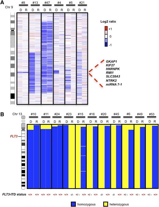 Figure 2. Visualization of recurrent deletions on 9q and UPD on 13q that were present at diagnosis (indicated as D) and/or relapse (indicated as R) by dCHIP. (A) Log2 ratios of 6 patients with del(9q) at the time of diagnosis. Patients #8, #13, and #47 maintained the same deletions at both time points, whereas in patients #4, #5, and #21, del(9q) was lost. Blue indicates deleted and red indicates gained chromosomal segments. (B) Cases with UPD13q at diagnosis and relapse (n = 3), at diagnosis only (n = 1), or at relapse only (n = 7). Mutation status is indicated below the corresponding FLT3-ITD mutation: −/− no mutation; −/+, heterozygous mutation; +/+ homozygous mutation. Blue indicates homozygous (= LOH) and yellow heterozygous regions of chromosome 13 as determined by SNP profiling.