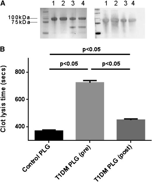 Figure 1. Plasma-purified plasminogen integrity and analysis of fibrinolytic activity. (A) SDS-PAGE (left) and western blot using anti-plasminogen antibody (right). Lanes 1 and 2: commercial plasminogen. Lane 3: plasma-purified plasminogen from a healthy control. Lane 4: plasma-purified plasminogen from a subject with T1DM. (B) Turbidimetric analysis of clot lysis using commercial fibrinogen and plasminogen purified from 10 T1DM samples pre- and postimprovement of glycemia (HbA1c 10.7 and 8.2%, respectively). Plasmin(ogen) fibrinolytic activity from pooled healthy control plasma (n = 20) is also shown. PLG, plasminogen.