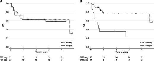 OS analysis of patients with stage IV disease, by marrow status. (A) OS by PET. Patients with marrow involvement detected by PET had similar OS to those individuals with stage IV disease without an involved marrow. (B) OS by BMB. Patients with positive marrow involvement by histology had significantly inferior OS compared with patients with negative histology. neg, negative; PET, positron emission tomography; pos, positive. Adapted from Figure 4 (panel A from 4B; panel B from 4D) in the article by Khan et al that begins on page 61.