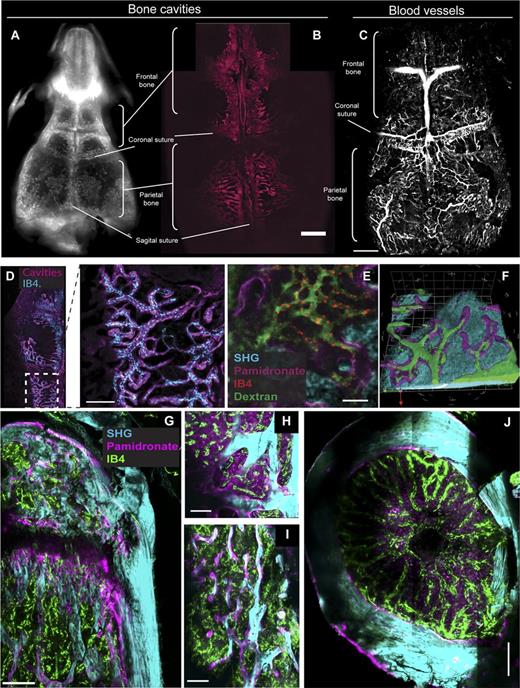 Figure 1. Comparison of the vascularization in calvaria and long bones. Structural characterization of the calvarium using in situ imaging of BRA as revealed by an NIR-pamidronate probe. Visualization using an NIR scanner (A) and confocal microscope (B). Scale bar represents 700 μM. (C) A 3D reconstruction of BM vasculature in the calvarium where blood vessels are contrasted using nontargeted Quantum dots. The 3D tiling was applied to acquire 16 × 23 adjacent stacks of 15 steps, covering a 6800-µm/9780-µm/600-µm volume. Scale bar represents 1 mm. (D) Combined BRA and vasculature contrasting obtained after intravenous injection of NIR-pamidronate and IB4-Alexa568, imaged in intact BM. Vasculature can be seen to be in close contact with the bone. Scale bar represents 300 µm. (E) Four-color live tissue imaging combining NIR-pamidronate (endosteum), IB4-Alexa568 (endothelial cells), and FITC-dextran (blood plasma) with simultaneous detection of SHG (bone). (F) A 3D model of bone (SHG, blue), bone endosteum (NIR-pamidronate, purple), and blood vessels contrasted with FITC-dextran (green). (G-J) Ex vivo imaging of long bones (SHG, cyan) after in vivo contrasting with NIR-pamidronate (purple) and IB4-Alexa488 (green). Sagittal section of tibia epiphysis (G) with details of the trabecular region (H). Scale bars represent 200 and 100 µm, respectively. Transverse section of femur metaphysis (I) and diaphysis (J). Scale bar represents 200 µm.