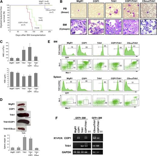 Figure 6. COP1 cooperates with Trib1 to induce ACL. Mice were transplanted with BM cells infected with retroviral vectors containing MigR1 (GFP+) control, COP1 (GFP+), CSmut (GFP+), and Trib1 and examined several months after BMT. (A) Myeloid leukemia-free survival curves of transplanted mice. Results are derived from 3 independent transfer experiments. The P value between Trib1 and COP1/Trib1 mice was calculated with log-rank test. P < .05. (B) May-Grunwald Giemsa–stained peripheral blood (PB) smears and cytospins of BM cells. (C) The counts of leukocytes (WBC) and hemoglobin (HGB). (D) Spleen weights of individual mice. Data presented in C and D are averages of 5 independent experiments shown as means ± SD. (E) Fluorescence-activated cell sorter analysis of BM and spleen cells for immature (Mac-1+Gr-1lo) and differentiated (Mac-1+Gr-1hi) granulocytes. The population of GFP-positive cells in BM and spleen is shown in the upper panels. (F) Total RNA extracted from GFP-positive BM cells was analyzed by quantitative RT-PCR using a pair of primers specific to COP1, Trib1, and GAPDH.