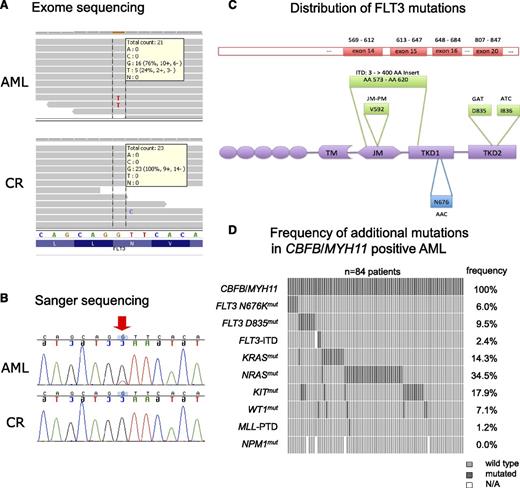 Figure 1. FLT3 N676K mutations identified in CBFB/MYH11-rearranged AML. (A) Exome data sets of a CBFB/MYH11-positive AML sample (upper panels) and the corresponding follow-up sample from the same patient (lower panels) are displayed using the integrative genomics viewer.24 Horizontal gray bars symbolize the 76-bp reads aligned to the reference sequence. The frequency of 24% of the mutant nucleotide T in the diagnostic leukemia sample indicates a heterozygous point mutation causing an amino acid substitution (NM_004119.2:c.2028C>A; p.N676K), whereas in the follow-up sample, only the wild-type nucleotide G is detected at this position. Read depth and base count are indicated for the affected positions, respectively. (B) Sanger sequencing confirmed the FLT3 N676K mutation found initially by exome sequencing. Chromatograms are shown for both the diagnostic AML sample and the corresponding follow-up sample at complete remission (CR) from the same patient. (C) The structure of the human FLT3 protein includes the transmembrane domain (TM), the juxtamembrane domain (JM), and TKD1 and TKD2. Amino acid positions targeted by known recurrent mutations in AML are indicated in green above the corresponding domains. N676 is indicated in blue below the TKD1 domain. (D) Frequency distribution of additional genetic aberrations in 84 CBFB/MYH11-rearranged patients. Each column indicates one patient. Dark gray boxes indicate patients who are positive for the respective mutation; light gray boxes indicate wild-type status. Missing information is shown as a white space (N/A, not available). Gene names and types of mutations are indicated on the left. Mutation frequencies are indicated on the right. MLL-PTD, partial tandem duplications in the MLL gene.