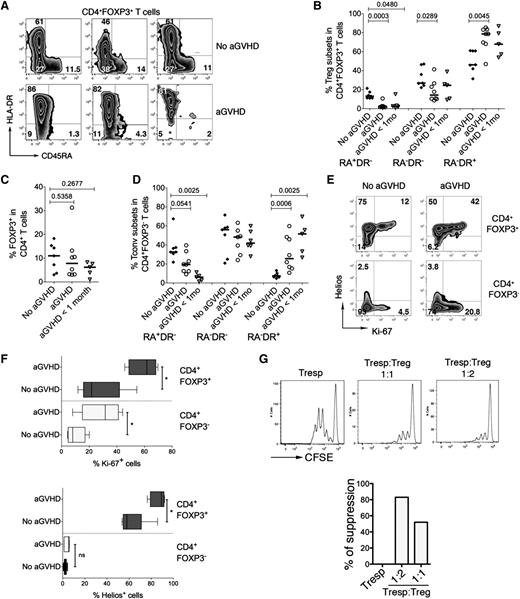 Figure 5. Altered homeostasis of CD4+FOXP3+ T cells in patients developing acute graft-versus-host disease after alloHSCT. Analysis of Treg subpopulations was performed in 20 consecutive alloHSCT recipients. Patients were analyzed at the time of engraftment (2-3 weeks after alloHSCT, see supplemental Table 2 for patient characteristics). In the control group (No aGVHD), a blood sample was collected at time of hematopoietic recovery (group 2, n = 7). In patients with aGVHD (n = 8), a blood sample was collected at diagnosis of aGVHD, before steroid treatment initiation. Patients in the group “aGVHD <1 mo” (n = 5) did not display symptoms of aGVHD at the time of analysis at the time of engraftment but developed aGVHD within 1 month after sampling (ie, 2 months after alloHSCT). (A) Expression of HLADR and CD45RA in the peripheral blood CD4+FOXP3+ T-cell compartment was analyzed by flow cytometry. (B-C) Plots represent the frequencies of the three Treg subpopulations within CD4+FOXP3+ T cells in 7 patients without aGVHD, 8 patients developing aGVHD, and 5 patients developing aGVHD within 1 month after sampling (B) and percentages of total CD4+FOXP3+ T cells within CD4+ T cells (C). (D) Expression of HLA-DR and CD45RA in the CD4+FOXP3− T-cell compartment. P values were obtained using the 2-tailed nonparametric Mann-Whitney test. (E) Tregs and Tconvs were analyzed by flow cytometry for the expression of Helios and Ki-67. (F) Percentage of Ki-67+ (top panel) and Helios+ cells (bottom panel) in CD4+FOXP3+ Tregs and conventional CD4+FOXP3− T cells in patients with aGVHD (n = 5) and patients not developing aGVHD (n = 6, No aGVHD). Five patients with aGVHD and 6 patients without aGVHD were analyzed. (G) Suppression assays were performed with Tregs and Tconvs from a patient with aGVHD. Ratios of 1:1 and 1:2 (Tresp:Treg) were used.