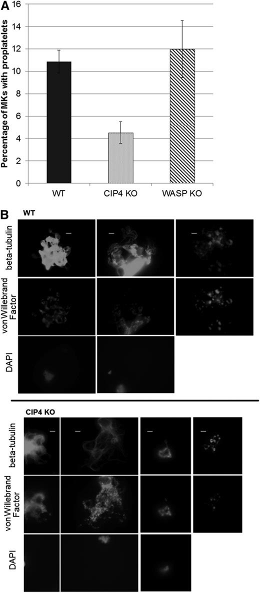 Figure 3. Impaired proplatelet formation in CIP4-null MKs. (A) CIP4-null MKs form less proplatelets. CIP4-null, WASP-null, and WT megakaryocytes were grown in culture in suspension with TPO. At day 4, the percentage of proplatelet-forming MKs was reported by scoring 300 MKs. The data shown are the average ± standard error of the mean from 3 independent experiments, except for WASP KO, which was performed twice. (B) CIP4 KO cells are mechanistically able to extend tubulin loops in their proplatelets tips. The cells were stained with immunofluorescence on day 4 or 5 of culture with TPO for β-tubulin (Alexa-488 conjugated secondary antibody) to look for ability to form loops, for von Willebrand Factor (Alexa-594 conjugated secondary antibody), to document their megakaryocytic nature, and with 4,6 diamidino-2-phenylindole to show the nucleus. Top: pictures show WT megakaryocytes. Bottom: pictures show CIP4-null megakaryocytes. Last column: pictures show proplatelets detached from the bodies of megakaryocytes. The pictures were taken with a Leica DM 4000B microscope, visualized with a Leica DFC320 camera, and analyzed by using LAS software (Leica, Wetzlar, Germany). (Objective 100×/numerical aperture 1.3; bars represent 10 um).