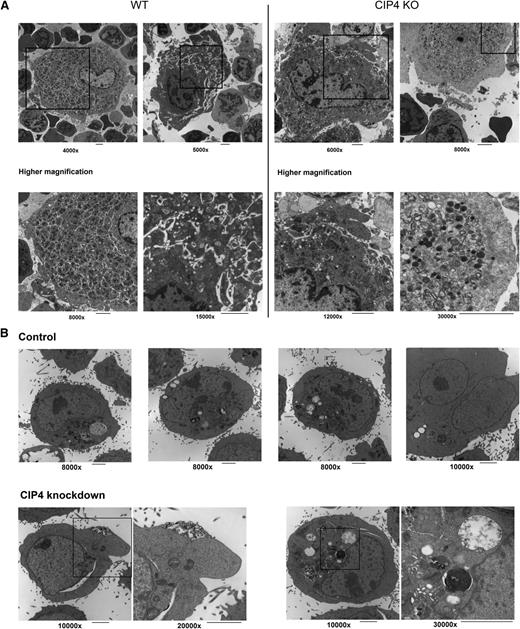 Figure 5. Ultrastructural features of CIP4-null MKs reveal reduced platelet territories. (A) TEM (JEM 1011, JEOL, Tokyo, Japan) analysis of bone marrow megakaryocytes from WT (left) vs CIP4 KO (right) mice revealed greatly reduced to completely missing platelet territories in CIP4 KO megakaryocytes. The DMS, which are membranes separating platelet territories, were either poorly defined or missing altogether in the CIP4 KO megakaryocytes. A minimum of 3 mice was analyzed for each group. Shown are representative images for each group. Magnification as mentioned on the figure; bar represents 2 um. Areas within the boxes are shown in the lower panel at a higher magnification. (B) Ultrastructural features of CHRF-288-11 cells. Bottom images: signs of membrane disruption of the plasma membrane and vacuole membrane are evident in cells with CIP4 knockdown. Bottoms left 2 images: the plasma membrane is clearly disrupted in the CIP4 KD CHRF-288-11 cell, whereas a vacuole with protruding vesicles is seen in another cell (bottom right 2 images). Areas within the boxes are shown on the right adjacent side at a higher magnification.