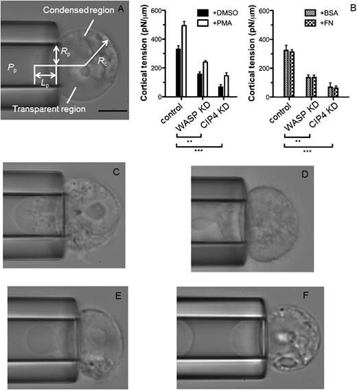 Figure 7. Loss of CIP4 reduces cortical tension in CHRF cells. (A) Photomicrograph of micropipette aspiration of a CHRF-288-11 cell. The pressure in buffer (P0), the suction pressure inside the pipette (Pp), the inner radius of the pipette (Rp), the radius of the spherical portion of the cell outside the pipette (Rc), and the length of the cell tongue aspirated inside the pipette (Lp) are indicated. Aspiration could cause polarization of cytoplasmic contents. The image shows the condensed region stays away from the pipette orifice where a transparent region is formed nearby. (B) Decreased cortical tension in CHRF cells after reduced levels of CIP4 or WASP either at baseline or after treatment with either PMA or fibronectin. **P ≤ .01; ***P ≤ .001. (C-D) Representative images of micropipette aspiration of an untreated cell without (C) with (D) CIP4 knockdown. Without CIP4 knockdown, the transparent region was aspirated furthest into the pipette and blebbing was rare. With CIP4 knockdown, cell swelling was observed under the isotonic condition. Repeated blebbing was observed in the inner transparent region inside the pipette. (E-F) Blebbing of CHRF cells. (E) Initiation of membrane blebbing. The near-orifice transparent region was pinched off and transformed into a bubble-like protrusion. The dynamic process was driven by the sucking pressure. (F) Repeated blebbing. The protruded bleb was snitched out, followed by a newly-extruded immature bleb. (Magnification 40×; bar represents 5 um). Images were obtained with an inverted microscope with 40× dry lens (Nikon TiE, Nikon, Tokyo, Japan) through a camera (GC1290, Prosilica, Allied Vision Technologies, Augusta Technologie, Munich, Germany) that has a standard video rate (30 frames per second). The acquisition program was home-made.