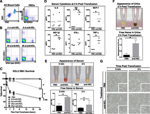 Figure 2. Anti-KEL antibodies induce clearance of KEL2 RBCs. Naïve WT recipients were passively immunized with phosphate-buffered saline (PBS) or titrated amounts of anti-KEL antisera and subsequently transfused with DiI-labeled KEL2 and DiO-labeled WT RBCs. (A) Gating strategy of DiI-positive KEL2 or DiO-positive B6 RBCs. (B-C) Clearance was determined by calculating the ratio of DiI-labeled KEL2 to DiO-labeled WT RBCs after passive antibody transfer. (D) Serum cytokines 2 hours posttransfusion. (E) Heme in serum and (F) heme in urine posttransfusion. (G) Wright-Giemsa–stained blood smears. These data are representative of 2 independent experiments, with 3-5 animals/group/experiment; error bars indicate standard deviation. *Statistical significance, P < .05.