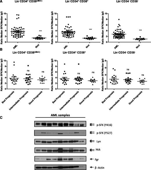 Figure 1. SFKs are constitutively activated in AML stem and progenitor cells independent of the cytogenetic risk. (A) Flow cytometry analysis of SFKs using a phosphospecific antibody recognizing the activated form of SFK members (Y416) in normal (Nml) or AML stem/primitive cells Lin−CD34+CD38dim/−, AML progenitors cells Lin−CD34+CD38+, and AML more mature cells Lin−CD34−CD38−. Scatter plots comparing SFK phosphorylation (expressed as ratio of median fluorescence intensity for pSFK vs isotype control) in LinCD34+CD38dim/−, Lin−CD34+CD38+, and Lin−CD34−CD38− cells from AML (n = 56) and normal samples (n = 12; 3 BM, 4 CB, and 5 PBSC samples; ***P < .002). (B) Scatter plots comparing SFK phosphorylation in primary AML patients according to their prognostic risk category (bad, intermediate, and good prognosis). ns, non significant. (C) Western blots analysis for fresh or thawed CD34+ AML samples. Indicated antibodies are listed, and β-actin was used as a loading control. Results shown are representative of 9 AML samples analyzed.