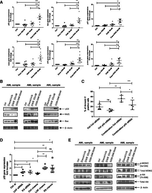 Figure 7. Dasatinib combined with chemotherapy enhances p53 transcriptional activity and modulates the Akt-HDM2 axis in AML CD34+ cells. (A) Quantitative PCR analysis of p53 and p53 target genes in primary AML CD34+ cells exposed for 16 hours to dasatinib alone (200 nM), DNR alone (50 nM), or dasatinib 200 nM in combination with DNR. β-2M was used as an internal control and results shown are expressed as mean ± SEM of 8 AML samples. One-way ANOVA with posttest: ns, nonsignificant; *P < .05; **P < .01; ***P < .001; ****P < .0001. (B) Western blot analysis for AML samples exposed for 48 hours to dasatinib alone (200 nM), DNR alone (50 nM), or dasatinib in combination with DNR. Indicated antibodies are listed and β-actin was used as a loading control. Results shown are representative of 7 AML samples analyzed. (C) Twenty-four hours postnucleofection, AML samples (n = 4) were treated without or with dasatinib (200 nM) + DNR (50 nM) and assayed for apoptosis after 2 more days. Results shown are presented as mean percentages ± SEM of Annexin V-positive cells in control versus p53 siRNA and in treated versus untreated cells. *P < .0201; **P < .0039; ***P < .0003. (D) Twenty-four hours postnucleofection with indicated siRNA, AML samples (n = 5) were treated without or with dasatinib (200 nM) + DNR (50 nM) for 16 hours and p53 gene expression was assessed using quantitative PCR analysis. β2M was used as an internal control; results shown are expressed as mean ± SEM of 5 AML samples. ns, nonsignificant; *P < .0278; **P < .0072. (E) Western blot analysis for AML samples exposed for 2 hours to dasatinib alone (200 nM), DNR alone (50 nM) or dasatinib in combination with DNR. Indicated antibodies are listed and β-actin was used as a loading control. Results shown are representative of 7 AML samples analyzed.