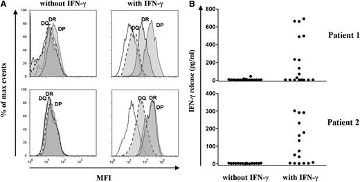 Figure 4. Recognition of skin-derived fibroblasts by allo-reactive HLA-DPB1–specific CD4 T-cell clones. (A) Expression of HLA-DR, -DQ, and -DP on skin fibroblasts from patient 1 (upper) and patient 2 (lower) cultured for 5 days with and without IFN-γ (200 IU/mL) was analyzed by flow cytometry. Histograms show the mean fluorescence intensity after staining with HLA-DR– (solid lines), HLA-DQ– (dashed lines), and HLA-DP– (dotted lines) specific moAb (filled histograms). Nonfilled histograms represent the MFI of unstained cells. (B) Reactivity of all allo-reactive HLA-DPB1–specific CD4+ T-cell clones from patient 1 (upper) and patient 2 (lower) was tested for cytokine production against skin-derived fibroblasts from the patients cultured with and without IFN-γ in ELISA. Each dot represents the release of IFN-γ (pg/mL) in 10 µL supernatants by a single CD4+ T-cell clone. None of the HLA-DPB1–specific CD4+ T-cell clones recognized skin fibroblasts in the absence of IFN-γ pretreatment, in line with the observed lack of HLA class II expression. From patient 1, 7 CD4+ T-cell clones specific for HLA-DPB1*0101 and 2 CD4+ T-cell clones specific for HLA-DPB1*0301 recognized skin-derived fibroblasts cultured with IFN-γ. From patient 2, 10 CD4+ T-cell clones specific for HLA-DPB1*0301 recognized skin-derived fibroblasts cultured with IFN-γ.