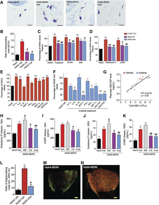 Figure 2. Mast cell activation contributes to neuro-inflammation in SCA. (A-K) HbSS-BERK mice were treated with saline (Veh), CS, or imatinib mesylate (Imat) for 5 days followed by analysis as indicated with each figure. (A) Representative images of Toluidine blue–stained dorsal skin sections. n = 6; bar = 100 μm. (B) Ratio of degranulating/total mast cells. *P < .01 vs HbAA-BERK, #P < .05 vs HbSS-BERK Veh (ANOVA, with Bonferroni). (C-D) Levels of tryptase, β-hexosaminidase (β-hex), SAP, SP, and CGRP expressed as the percentage of HbAA-BERK values. Red bars, HbSS-veh; magenta bars, HbSS-CS; blue bars, HbSS-Imat. *P < .05, **P < .01 vs HbAA-BERK, #P < .05, ##P < .01 vs HbSS-BERK Veh (ANOVA, with Bonferroni). (E-F) Cytokine released following 24 hours of incubation of skin from mice treated with vehicle or imatinib for 5 days. Black bars, HbAA-BERK Veh; red bars, HbSS-BERK Veh; blue bars, HbSS-BERK imatinib. Values are expressed as a percent of HbAA (E) or HbSS veh (F). *P < .05, **P < .01 vs HbAA-BERK Veh (E) or HbSS-BERK Veh (F) (Student t test). (G) Linear regression analysis of the expression of plasma GM-CSF and total WBC counts. (H-K) Neuropeptide release from the skin (H-I) and DRG (J-K) following 24 hours in culture. *P < .05, **P < .01 vs HbAA-BERK (H,J). *P < .05 vs HbSS-BERK Veh, **P < .01 vs HbSS-BERK Veh (I,K) (ANOVA, with Bonferroni). Each value is the mean ± SEM of 6 mice per group (in B-K). (L) Percentage of degranulating mast cells in DRG of mice treated with vehicle or imatinib for 5 days. *P < .001 vs HbAA-BERK Veh, #P < .05 vs HbSS-BERK Veh (ANOVA, with Bonferroni). (M-N) Representative confocal images showing coexpression of ATF3 (green) and GFAP (red). Scale bar, 100 µm; n = 6.